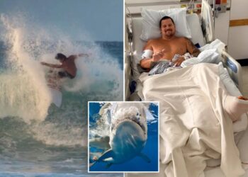 Surfer describes how 8-foot shark ripped open his legs: ‘My calf is pretty much wide open’
