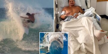 Surfer describes how 8-foot shark ripped open his legs: ‘My calf is pretty much wide open’