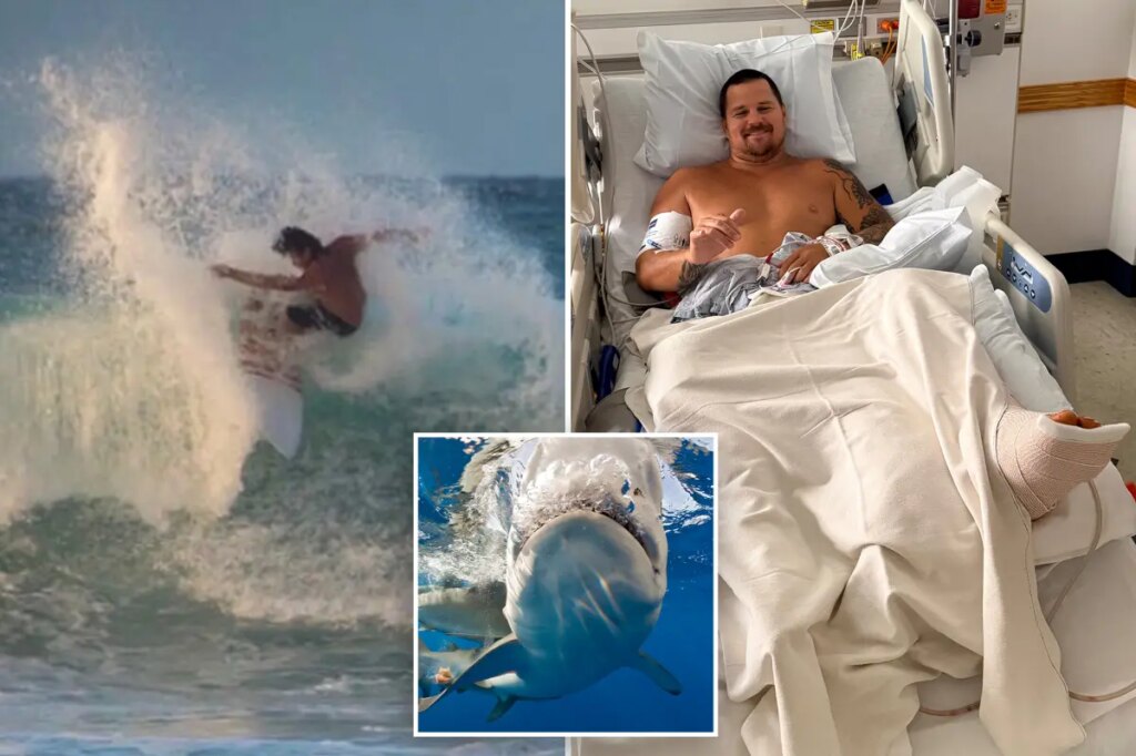 Surfer describes how 8-foot shark ripped open his legs: ‘My calf is pretty much wide open’