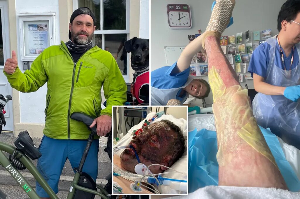 Dad survives five week coma after ‘fireball’ explosion while making gin