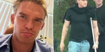 Cody Simpson ‘can’t walk or talk’ after horrifying double injury: ‘I’ll be back stronger’