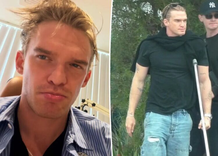 Cody Simpson ‘can’t walk or talk’ after horrifying double injury: ‘I’ll be back stronger’