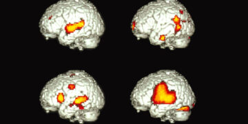 How Does One Brain Speak Two Languages?