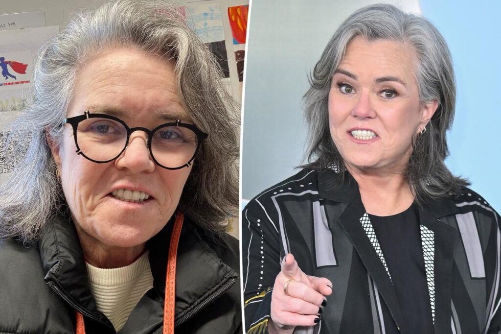 Rosie O’Donnell reveals whether she’ll undergo more plastic surgery after ‘shameful’ facelift