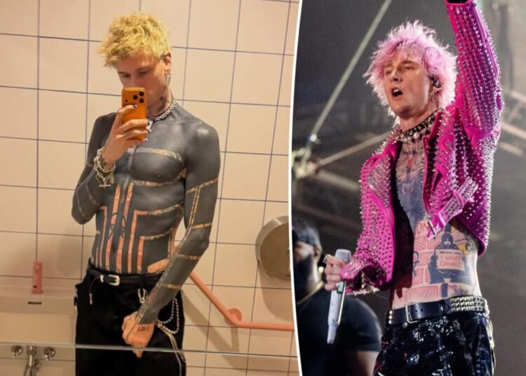 MGK shares scary side effects of ‘near impossible’ blackout tattoo journey