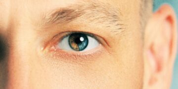 Trending Surgical Procedure That Changes the Color of Your Eyes Alarms Scientists