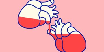 The organ donation boom complicating the boundary between life and death