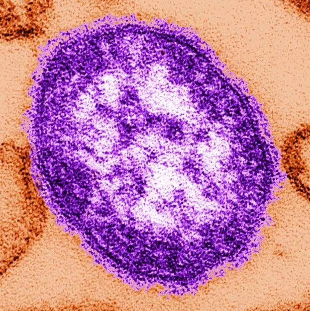 Measles virus particle.