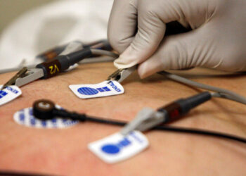 Doctors Thought It Was Asthma. A.I. Flagged a Serious Heart Problem.