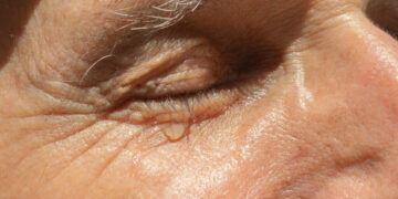 Why Old People Cry