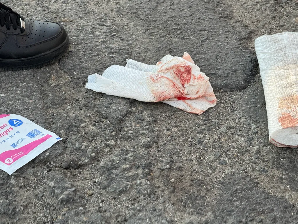 A bloody paper towel, a roll of paper towels with bloodstains, a package of Dynarex sponges, and a black sneaker on asphalt.
