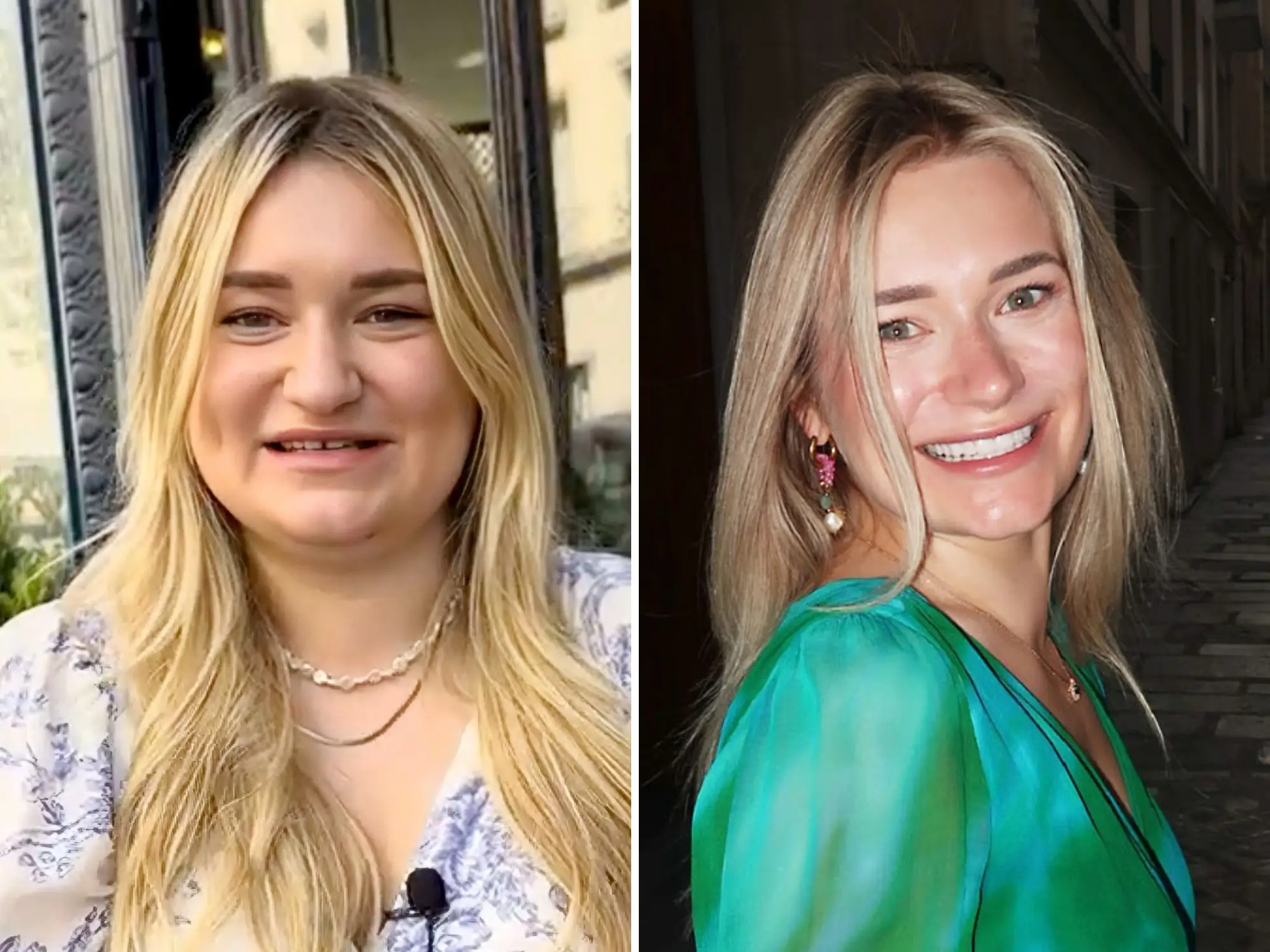 Before-and-after photos of a woman who underwent a radical transformation.