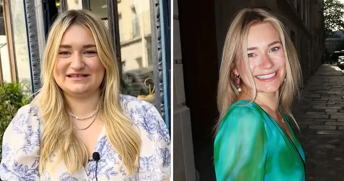 After a break-up, I paid $20K for a glow-up at 28. People on social media accuse me of using AI because I look so different.