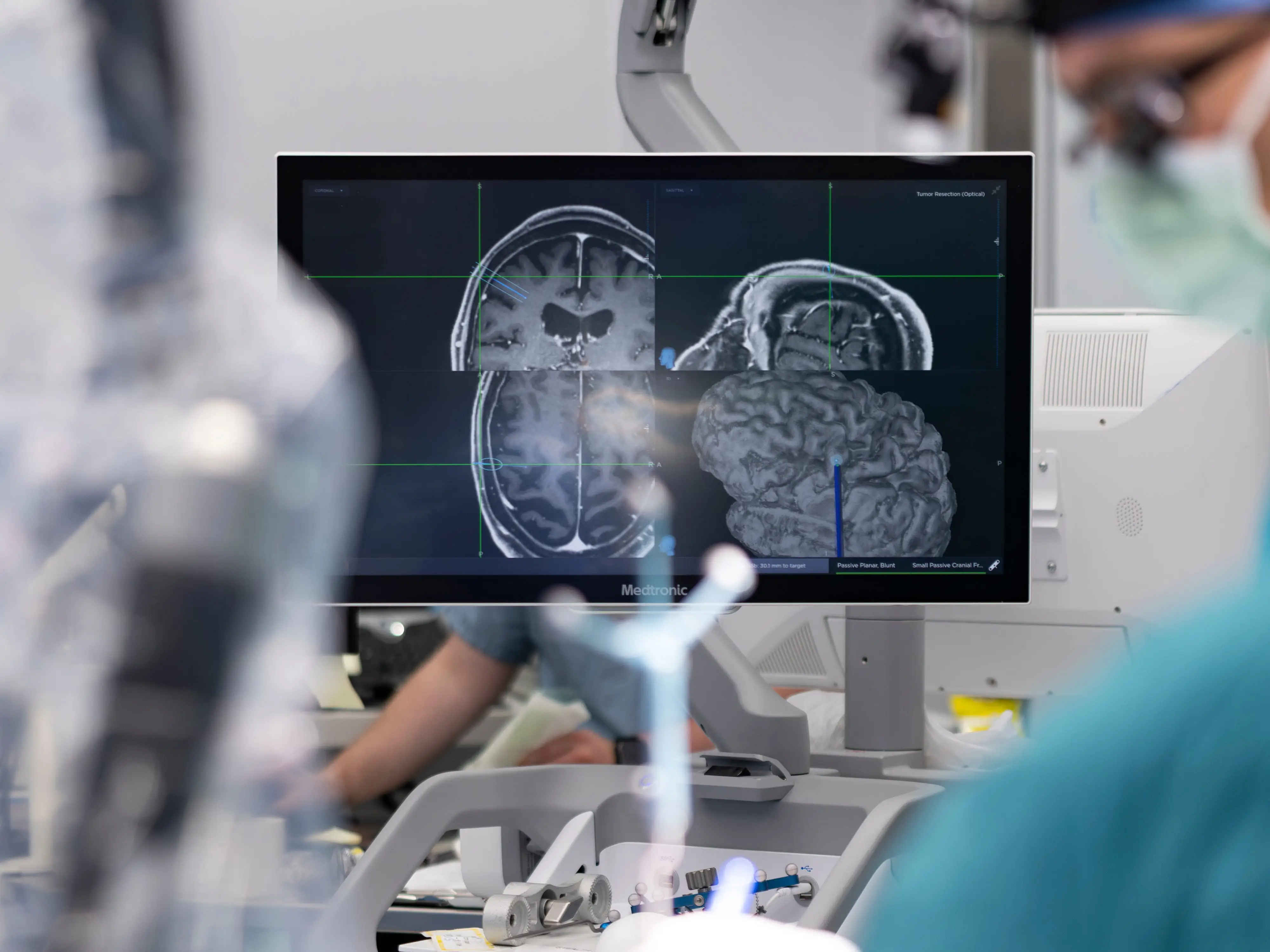 A monitor shows a scan of a patient's brain.