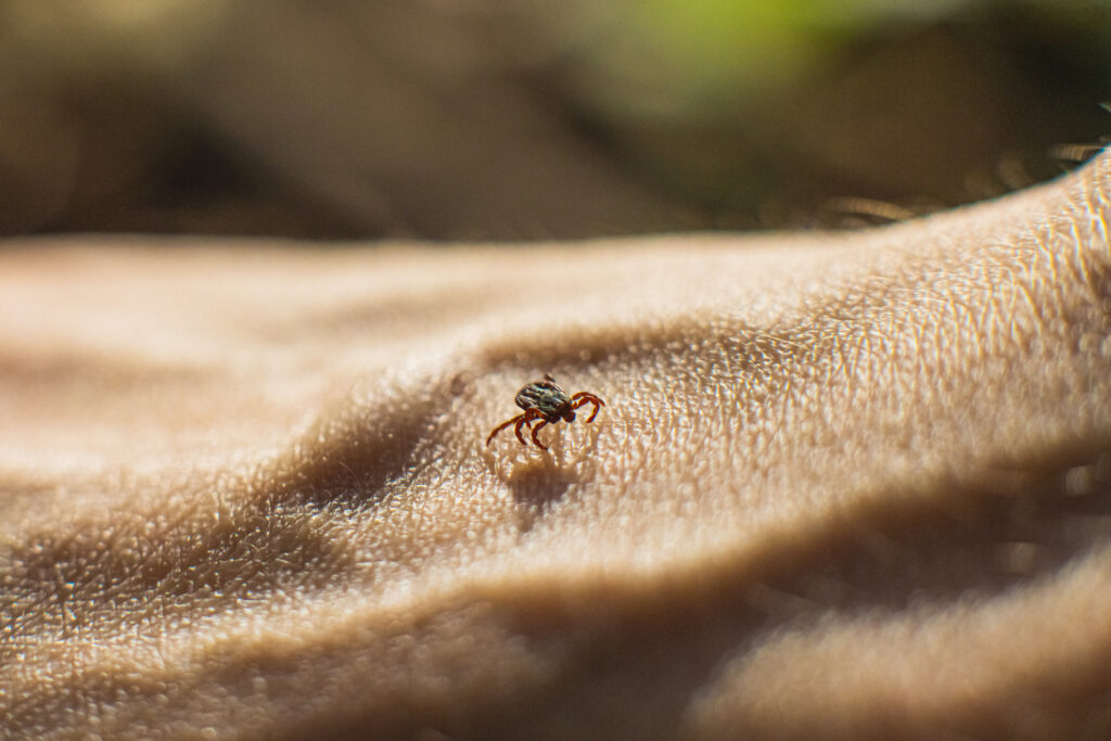 This rare tick-borne disease is on the rise in the U.S.