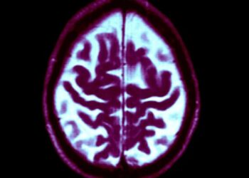 We’re not as helpless against dementia as we think