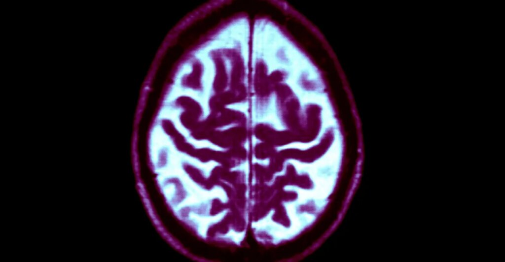 We’re not as helpless against dementia as we think