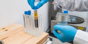 Early Research Suggests a Path to Predict and Prevent Lung Cancer