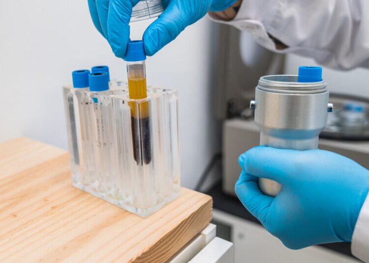 Early Research Suggests a Path to Predict and Prevent Lung Cancer