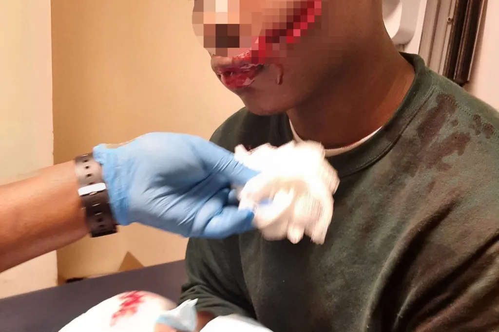 A person with pixelated facial injuries, including blood around their mouth, being attended to by a gloved hand holding gauze.