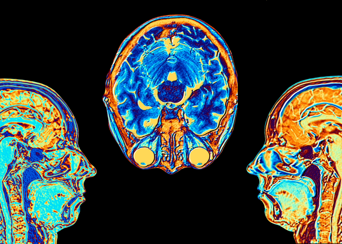 Why This Biotech Company Is Keeping Bodiless Human Brains Alive in a Lab