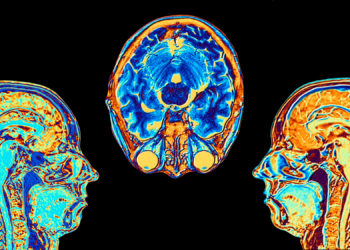 Why This Biotech Company Is Keeping Bodiless Human Brains Alive in a Lab