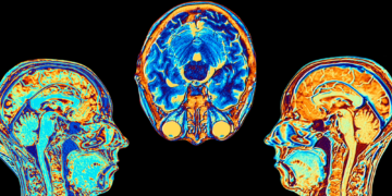 Why This Biotech Company Is Keeping Bodiless Human Brains Alive in a Lab