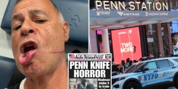 Penn Station slasher had ‘rage in his eyes,’ victim says while recalling NYC rampage: ‘Wanted to kill me’