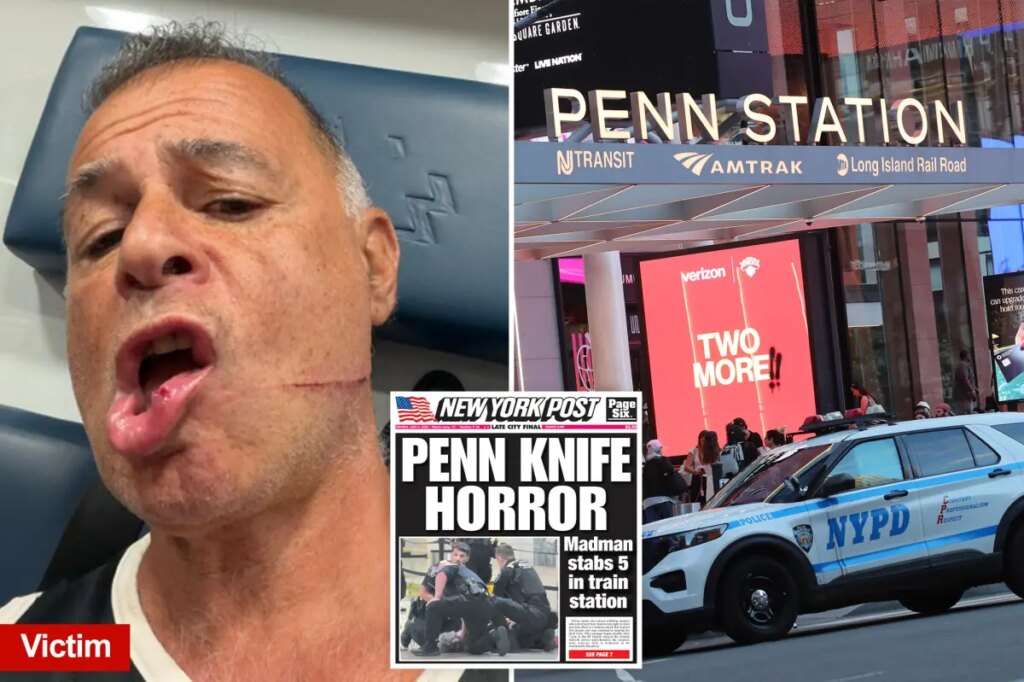 Penn Station slasher had ‘rage in his eyes,’ victim says while recalling NYC rampage: ‘Wanted to kill me’