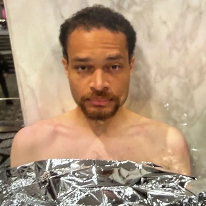 Cole Tomas Allen wrapped in a thermal blanket.