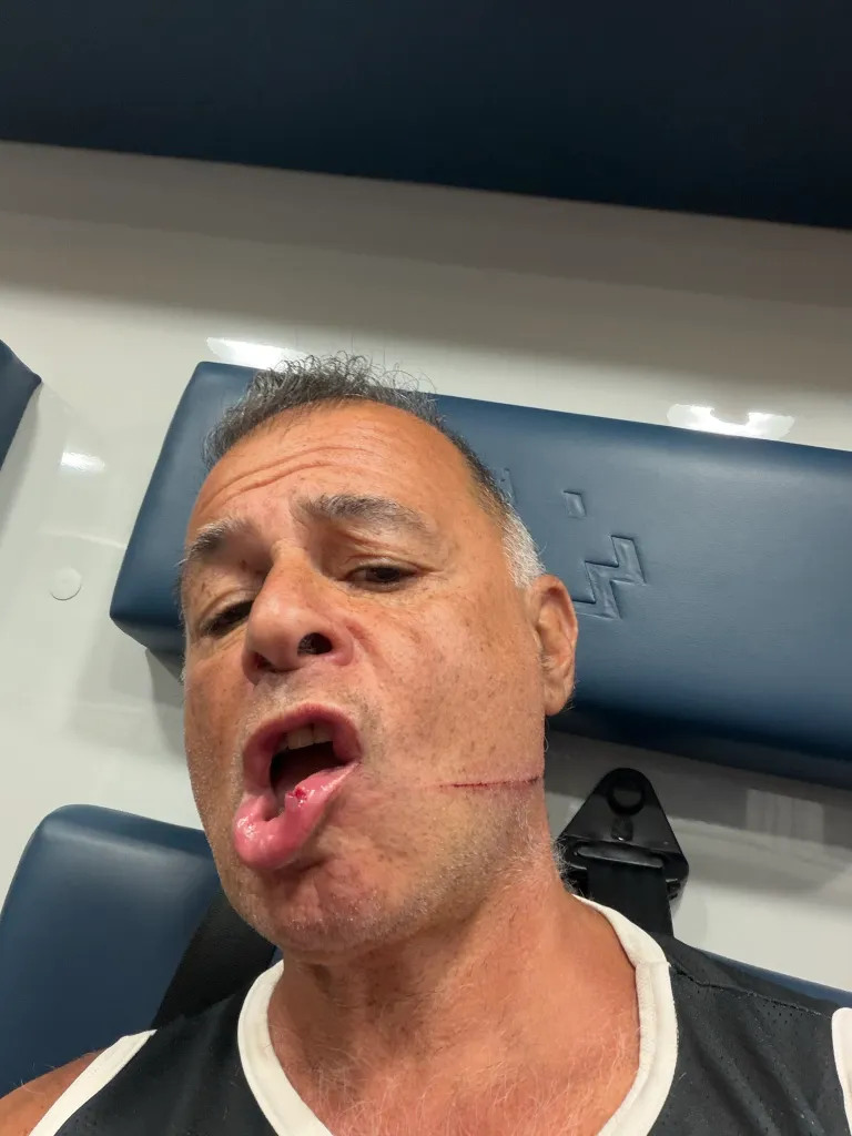 Henry Obadiah shows a gash on his face and a cut lip from a slashing attack.