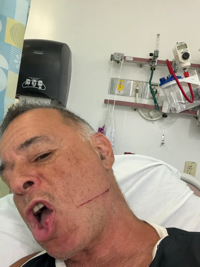 A man with a slash wound on his cheek and a busted lip lies in a hospital bed.
