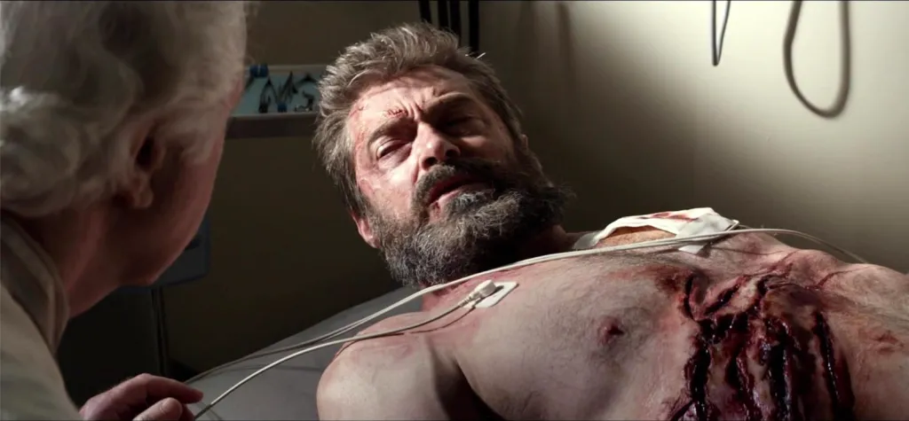Hugh Jackman as Wolverine, badly wounded, lying on a bed while James Handy looks on.