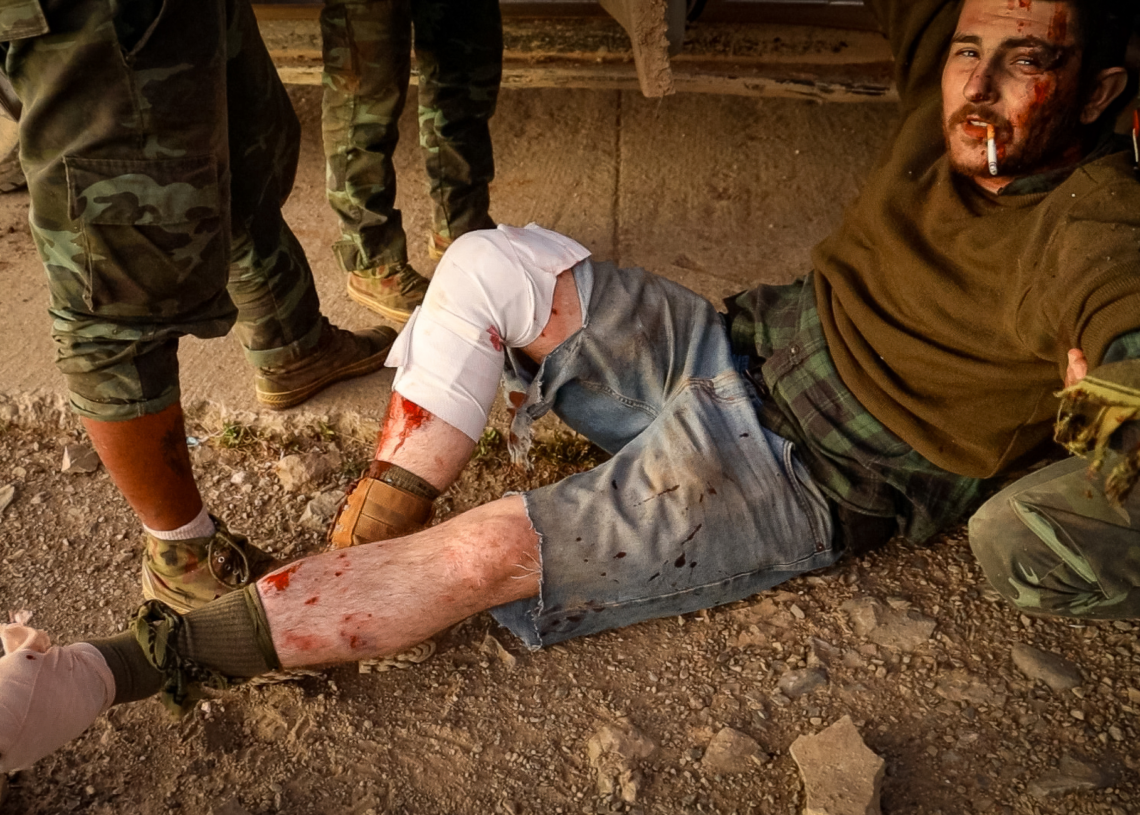 Experience: ‘I Just Trod on a Landmine!’