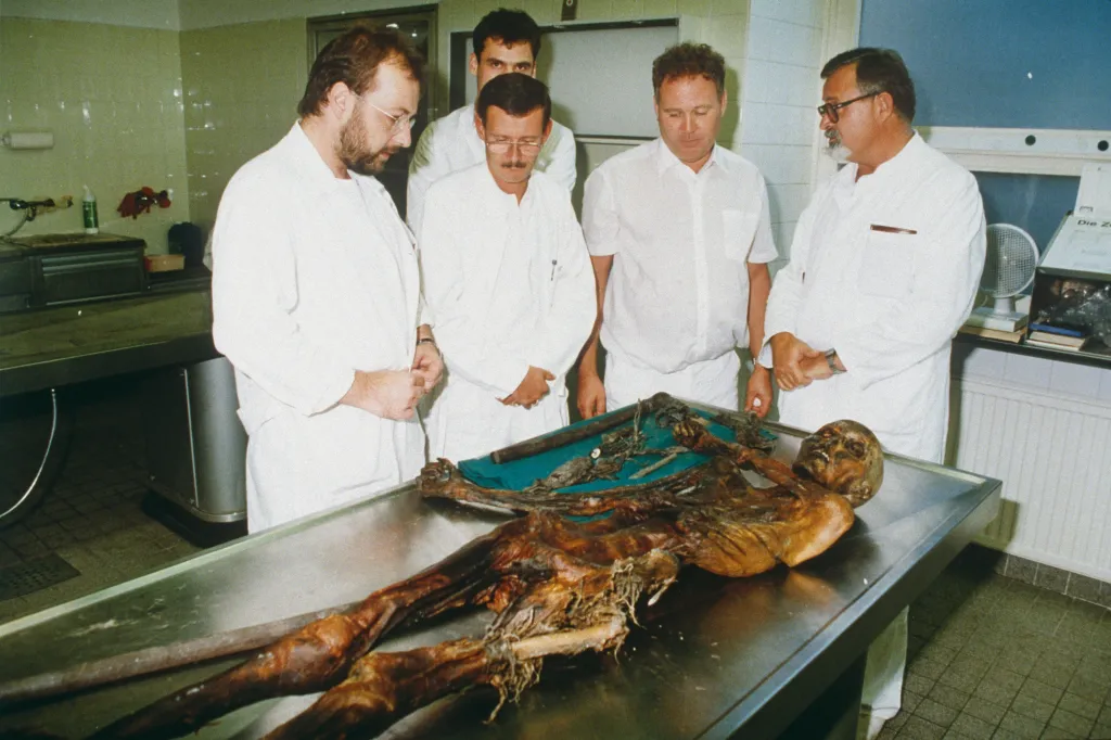 Five men in white lab coats examine the body of Otzi the Iceman on a metal slab.