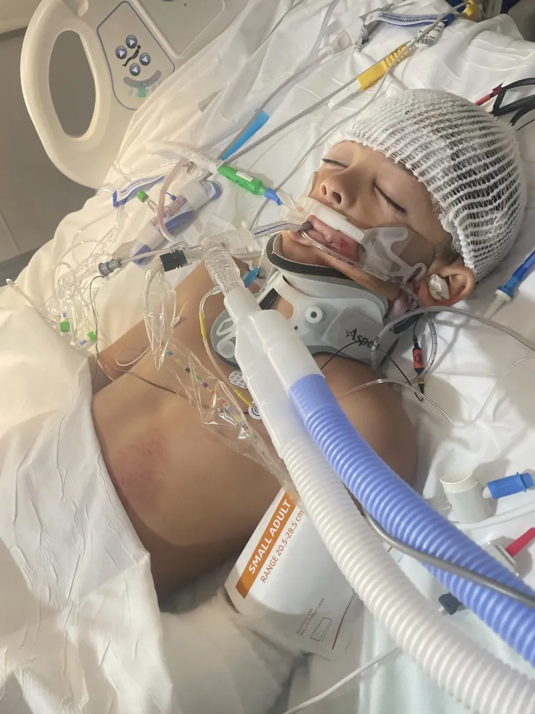 A child in a hospital bed with a cervical collar, breathing tube, and head wrap, surrounded by medical equipment.