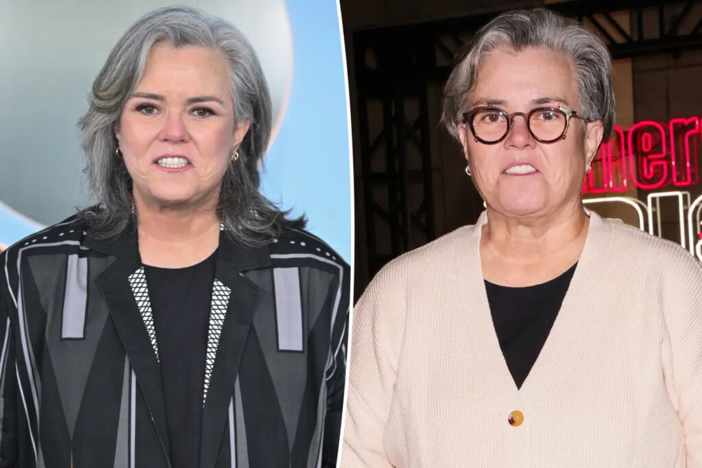 Rosie O’Donnell explains why she decided to reveal secret facelift: ‘People are lying about everything’