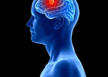 3 People Have Gotten Cancer-Detecting Implants in Their Brains