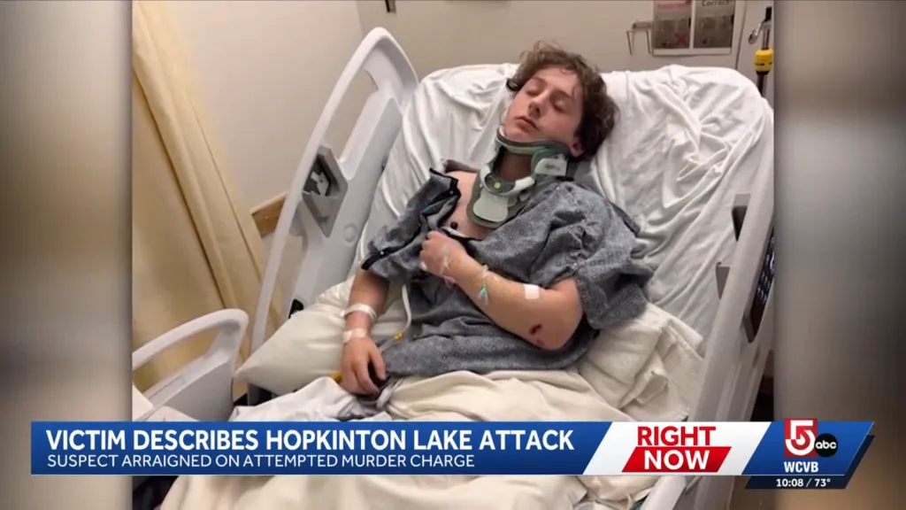 Duffy has been using crutches to get around after he was severely injured in an accident a few months ago.
