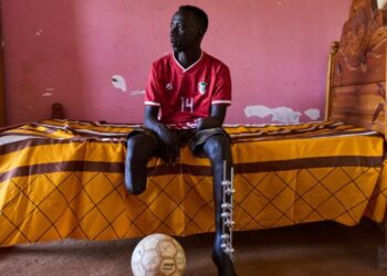 The scars of war among survivors in Sudan