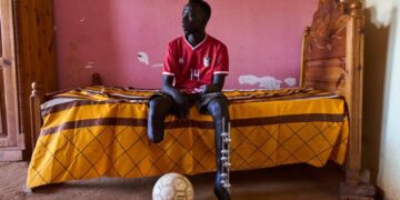 The scars of war among survivors in Sudan
