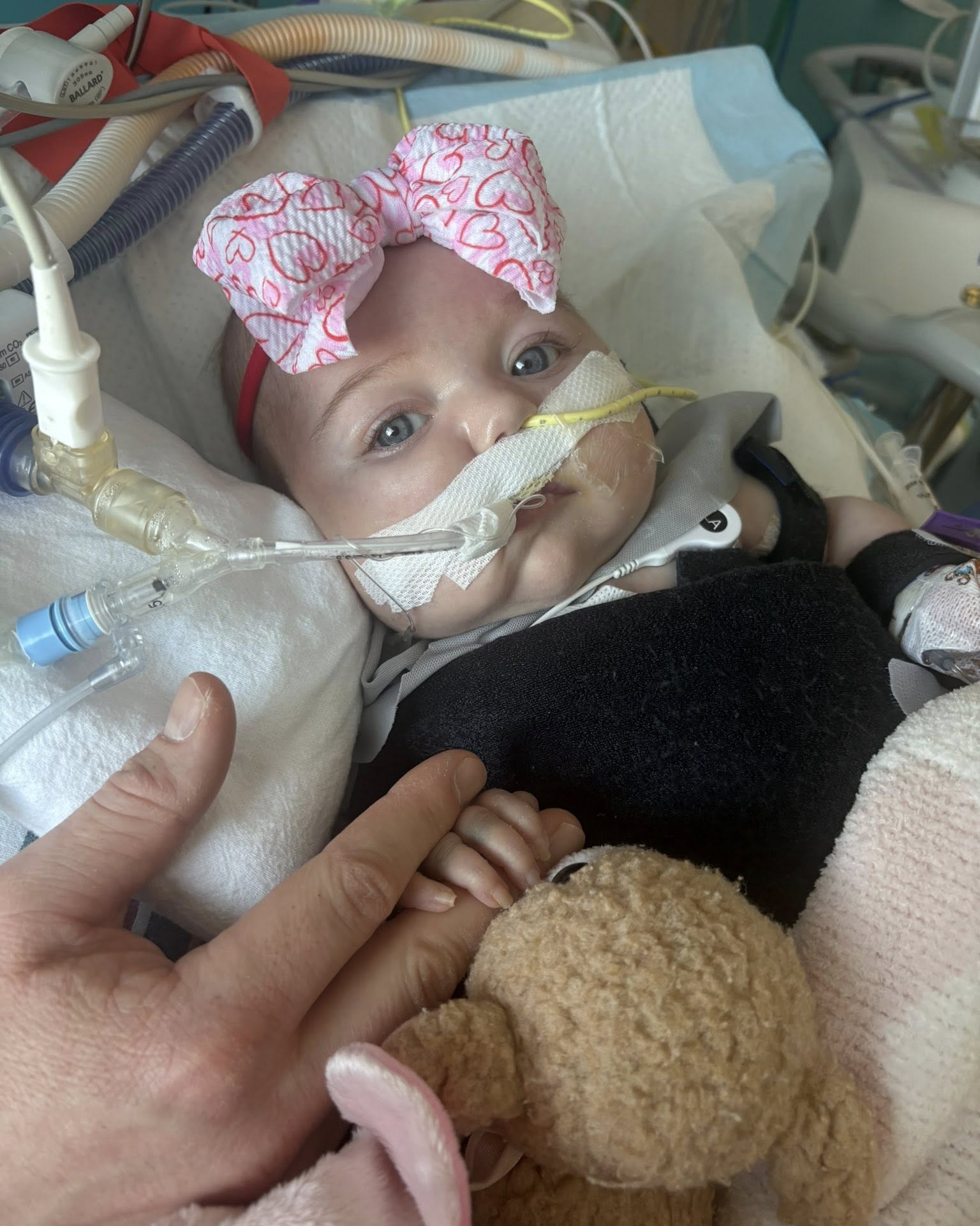 Infant with a large pink bow, medical tubes, and a hand holding their small hand in a hospital bed.