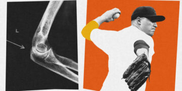 There’s an Injury Epidemic in Pro Sports. There’s Also a Recovery Revolution.
