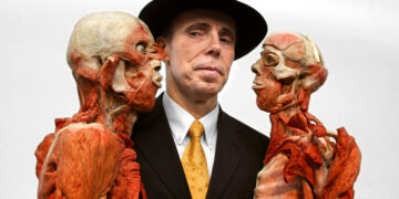 Gunther von Hagens, Creator of Polarizing ‘Body Worlds’ Exhibits, Dies at 81