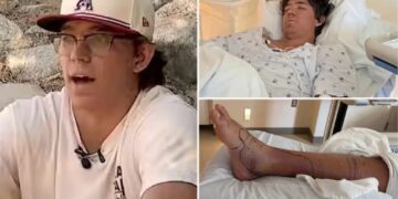 Baseball standout runs hospital dry of anti-venom after rattlesnake bite in desperate fight