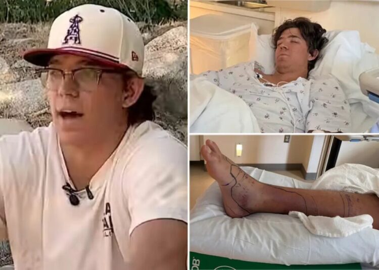Baseball standout runs hospital dry of anti-venom after rattlesnake bite in desperate fight