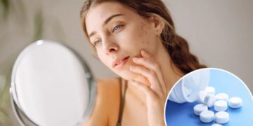 Do you have ‘ferritin face’? The mineral deficiency that could be messing with your looks