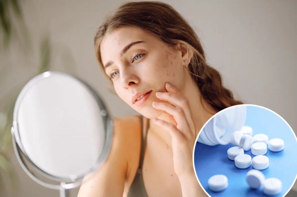 Do you have ‘ferritin face’? The mineral deficiency that could be messing with your looks