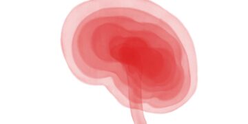 Cognitive Rehabilitation May Help Treat Long Covid, Study Says