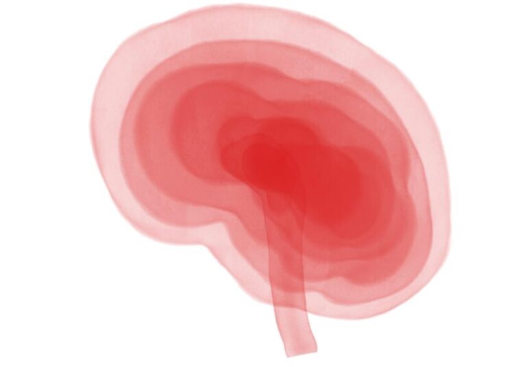 Cognitive Rehabilitation May Help Treat Long Covid, Study Says